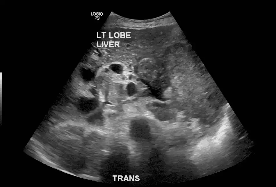 Ultrasound image of the abdomen